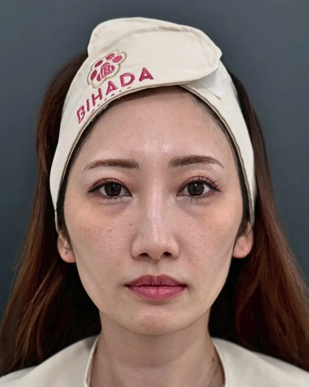 施術前