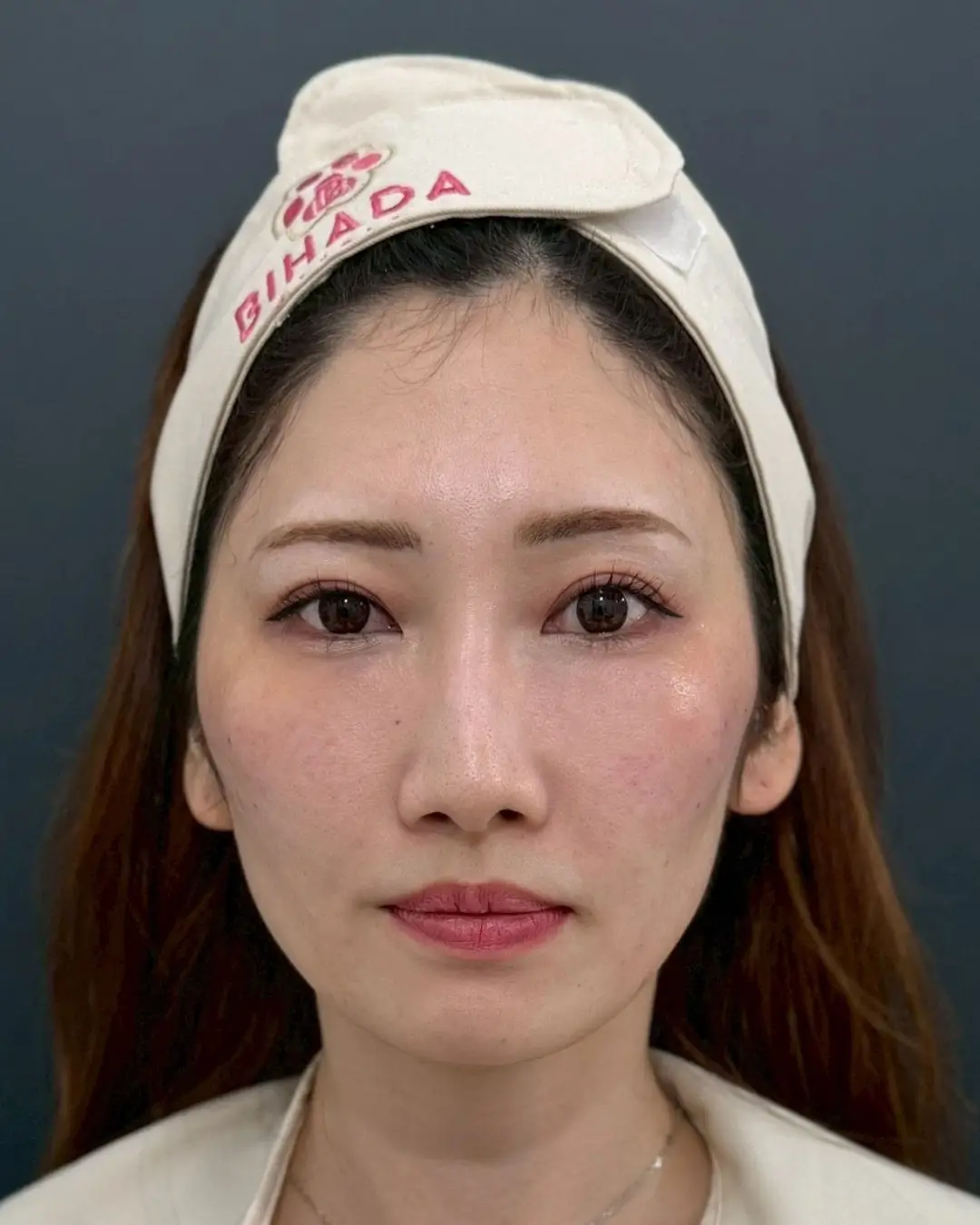 施術後